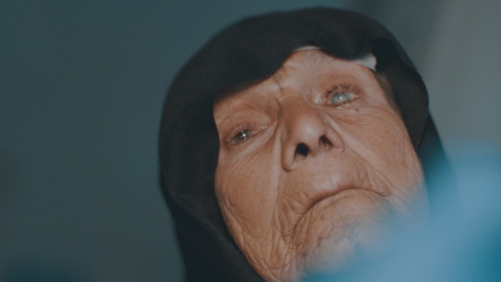 Las cataratas son la principal causa de ceguera en el mundo, una ceguera evitable.