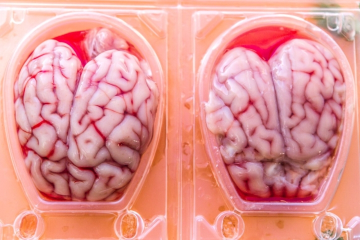 Con estos sesos dejarás alucinados a tus comensales y sí, se comen. Foto: David de Luis.